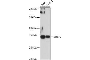 Western blot analysis of extracts of various cell lines, using SRSF2 antibody (ABIN1682677, ABIN3017915, ABIN3017916, ABIN5664377 and ABIN6220303) at 1:1000 dilution. (SRSF2 Antikörper  (AA 1-75))