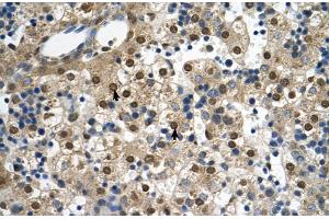 Rabbit Anti-SQLE Antibody  Paraffin Embedded Tissue: Human Liver Cellular Data: Hepatocytes Antibody Concentration: 4.