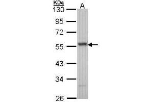 WB Image Sample (30 ug of whole cell lysate) A: H1299 10% SDS PAGE antibody diluted at 1:1000 (ERG Antikörper  (C-Term))