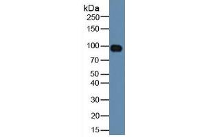 Rabbit Detection antibody from the kit in WB with Positive Control: Human serum.