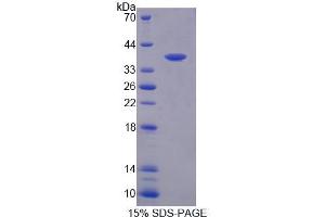 SDS-PAGE analysis of Human CEP55 Protein. (CEP55 Protein)