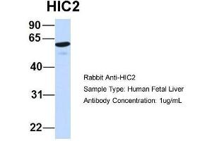 Host:  Rabbit  Target Name:  HIC2  Sample Type:  Human Fetal Liver  Antibody Dilution:  1. (HIC2 Antikörper  (Middle Region))