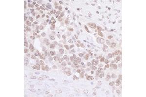 Immunohistochemistry (IHC) image for anti-MIS12, MIND Kinetochore Complex Component, Homolog (MIS12) (C-Term) antibody (ABIN7453483) (MIS12 Antikörper  (C-Term))