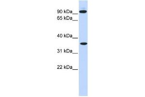 EXT2 antibody used at 1 ug/ml to detect target protein.