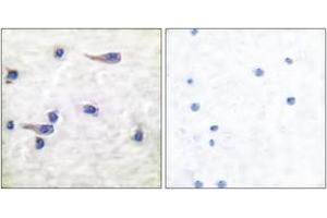 Immunohistochemistry analysis of paraffin-embedded human brain, using Tau (Phospho-Thr212) Antibody. (tau Antikörper  (pThr529))