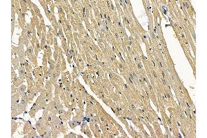 ABIN7097159 and ABIN7101227 at 1/100 staining rat heart tissue by IHC-P.