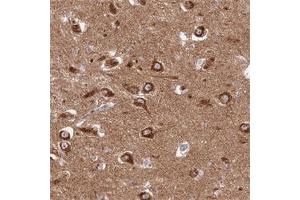 Immunohistochemical staining of human hippocampus with GOLGA3 polyclonal antibody  shows strong cytoplasmic positivity in neuronal cells at 1:500-1:1000 dilution. (Golgin A3 Antikörper)