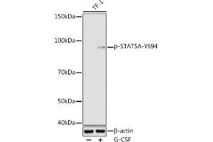 Western blot analysis of extracts of TF-1 cells, using Phospho-STA-Y694 antibody (ABIN3019613, ABIN3019614, ABIN3019615 and ABIN6225491) at 1:1000 dilution. (STAT5A Antikörper  (pTyr694))