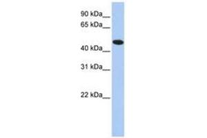 Image no. 1 for anti-Thioredoxin Domain Containing 5 (Endoplasmic Reticulum) (TXNDC5) (AA 36-85) antibody (ABIN6741464) (TXNDC5 Antikörper  (AA 36-85))