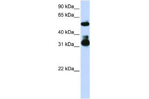 FBXW2 antibody used at 1 ug/ml to detect target protein.