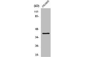 Western Blot analysis of COLO205 cells using ABHD6 Polyclonal Antibody (ABHD6 Antikörper  (Internal Region))