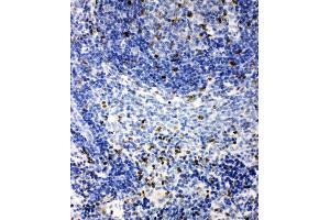 Anti-IRAK2 antibody, IHC(P) IHC(P): Rat Spleen Tissue (IRAK2 Antikörper  (C-Term))