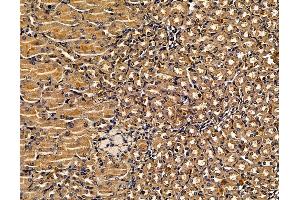 ABIN7095999 and ABIN7100061 at 1/100 staining mouse kidney tissue by IHC-P. (SOSTDC1 Antikörper)