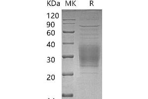 Western Blotting (WB) image for Triggering Receptor Expressed On Myeloid Cells 2 (TREM2) protein (His tag) (ABIN7320675)