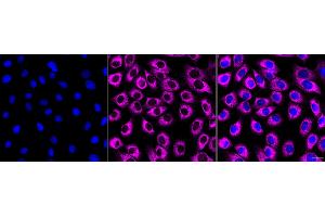 anti-RE1-Silencing Transcription Factor (REST) antibody