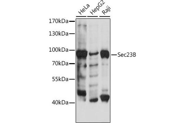 Sec23 Homolog B Antikörper  (AA 150-250)
