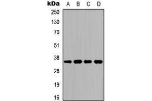 Western blot analysis of CD234 expression in HeLa (A), K562 (B), Raw264. (DARC Antikörper  (N-Term))