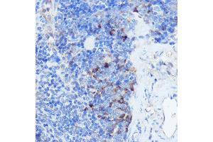 Immunohistochemistry of paraffin-embedded mouse spleen using IFNGR1 Rabbit pAb (ABIN6127566, ABIN6142197, ABIN6142198 and ABIN6221420) at dilution of 1:100 (40x lens). (IFNGR1 Antikörper  (AA 270-489))