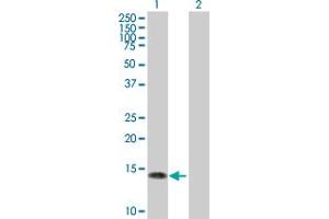 Nerve Growth Factor Receptor (TNFRSF16) Associated Protein 1 (NGFRAP1) (AA 1-101) Antikörper