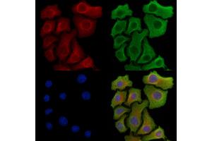 VEGFR1 Antibody staining Hela cells by IF/ICC.