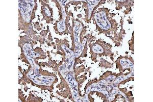 IHC analysis of MRPS22 using anti-MRPS22 antibody (ABIN7600613). (MRPS22 Antikörper  (AA 21-329))