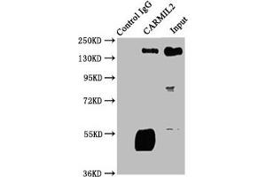 Immunoprecipitating CARMIL2 in Jurkat whole cell lysate Lane 1: Rabbit control IgG instead of ABIN7146660 in Jurkat whole cell lysate. (RLTPR Antikörper  (AA 1136-1290))