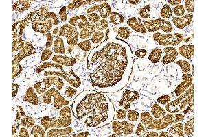 Immunohistochemical analysis of paraffin-embedded Human kidney section using Pink1 (ABIN6243087 and ABIN6577253). (MME Antikörper  (AA 472-505))