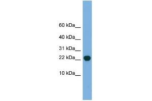 WB Suggested Anti-POP5 Antibody Titration: 0. (POP5 Antikörper  (Middle Region))