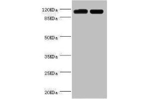 Western blot All lanes: PITRM1 antibody at 2 μg/mL Lane 1: A549 whole cell lysate Lane 2: Mouse kidney tissue Secondary Goat polyclonal to rabbit IgG at 1/10000 dilution Predicted band size: 118, 107 kDa Observed band size: 118 kDa (PITRM1 Antikörper  (AA 758-1037))
