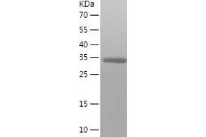 Western Blotting (WB) image for SERTA Domain Containing 2 (SERTAD2) (AA 1-314) protein (His tag) (ABIN7125059) (SERTAD2 Protein (AA 1-314) (His tag))