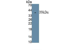 Detection of Recombinant DSPP, Human using Polyclonal Antibody to Dentin Sialophosphoprotein (DSPP)