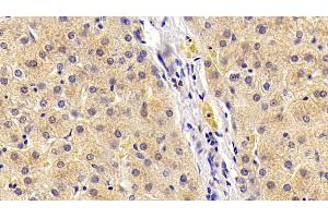 Detection of FGF21 in Porcine Liver Tissue using Polyclonal Antibody to Fibroblast Growth Factor 21 (FGF21) (FGF21 Antikörper  (AA 28-208))