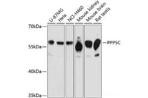Western blot analysis of extracts of various cell lines using PPP5C Polyclonal Antibody at dilution of 1:3000. (PP5 Antikörper)