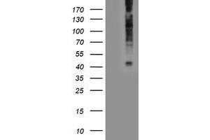 Western Blotting (WB) image for anti-Lysophosphatidic Acid Receptor 1 (LPAR1) antibody (ABIN1499191)