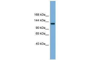 WB Suggested Anti-RASGRF1 Antibody Titration: 0. (RASGRF1 Antikörper  (Middle Region))