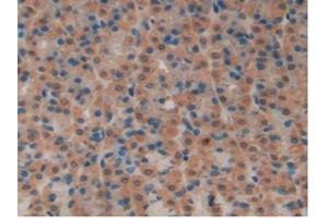 IHC-P analysis of Rat Stomach Tissue, with DAB staining. (SFTPB Antikörper  (AA 111-329))