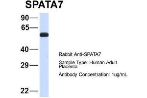 Host: Rabbit  Target Name: SPATA7  Sample Tissue: Human Adult Placenta  Antibody Dilution: 1. (SPATA7 Antikörper  (Middle Region))