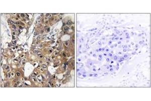 Immunohistochemistry (IHC) image for anti-CD9 (CD9) (AA 101-150) antibody (ABIN1534314)