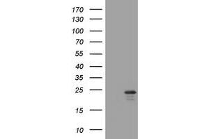 Image no. 1 for anti-Visinin-Like 1 (VSNL1) (AA 2-191) antibody (ABIN1491129) (VSNL1 Antikörper  (AA 2-191))