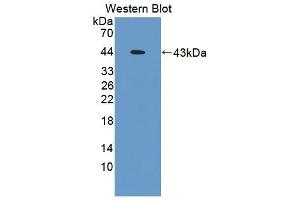 Detection of Recombinant TMOD3, Mouse using Polyclonal Antibody to Tropomodulin 3 (TMOD3) (TMOD3 Antikörper  (AA 1-352))