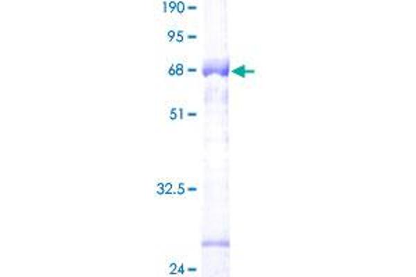 RPS2 Protein (AA 1-293) (GST tag)