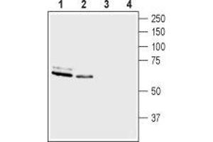 Western blot analysis of rat brain membranes (lanes 1 and 3) and mouse brain membranes (lanes 2 and 4): - 1,2. (ASIC3 Antikörper  (Intracellular))