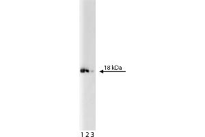Western Blotting (WB) image for anti-Eukaryotic Translation Initiation Factor 5A (EIF5A) (AA 58-154) antibody (ABIN968707)