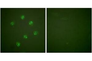 Immunofluorescence analysis of COS7 cells, using Ki67 Antibody.