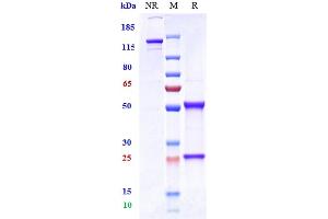 Anti-STEAP1 Reference Antibody (vandortuzumAb) on SDS-PAGE under reducing (R) condition.