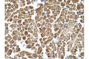 Tropomyosin 2 antibody was used for immunohistochemistry at a concentration of 4-8 ug/ml. (TPM2 Antikörper)