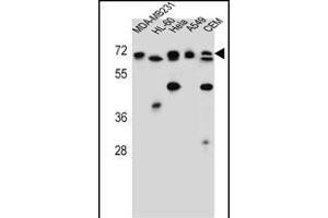 ASMTL Antibody (Center) (ABIN657160 and ABIN2846294) western blot analysis in MDA-M,HL-60,Hela,A549,CEM cell line lysates (35 μg/lane). (ASMTL Antikörper  (AA 231-259))