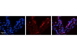 Immunohistochemistry (IHC) image for anti-Signal Transducer and Activator of Transcription 6, Interleukin-4 Induced (STAT6) (C-Term) antibody (ABIN2780481) (STAT6 Antikörper  (C-Term))