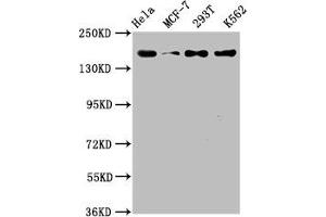 Western Blot Positive WB detected in: Hela whole cell lysate, MCF-7 whole cell lysate, 293T whole cell lysate, K562 whole cell lysate All lanes: HDAC9 antibody at 1.