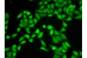 Immunofluorescence analysis of MCF-7 cells using R antibody (ABIN6131708, ABIN6141226, ABIN6141228 and ABIN6217372). (GNB2L1 Antikörper  (AA 30-290))
